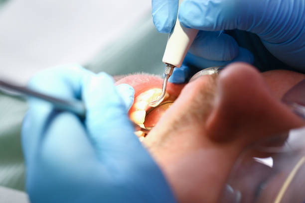 Best 24-Hour Emergency Dental Care in New California, OH