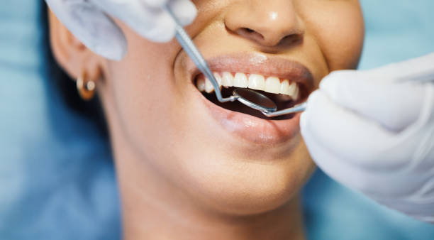 Best Dental Abscess Treatment in New California, OH